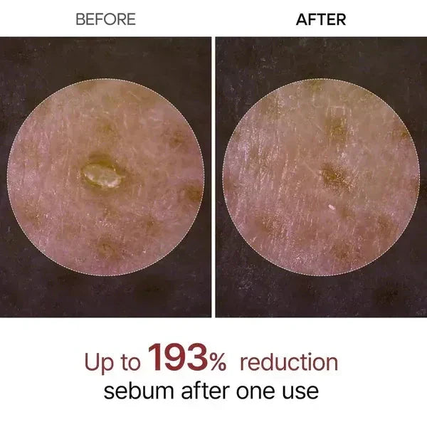 Dr. Melaxin Rice Peel Ampoule